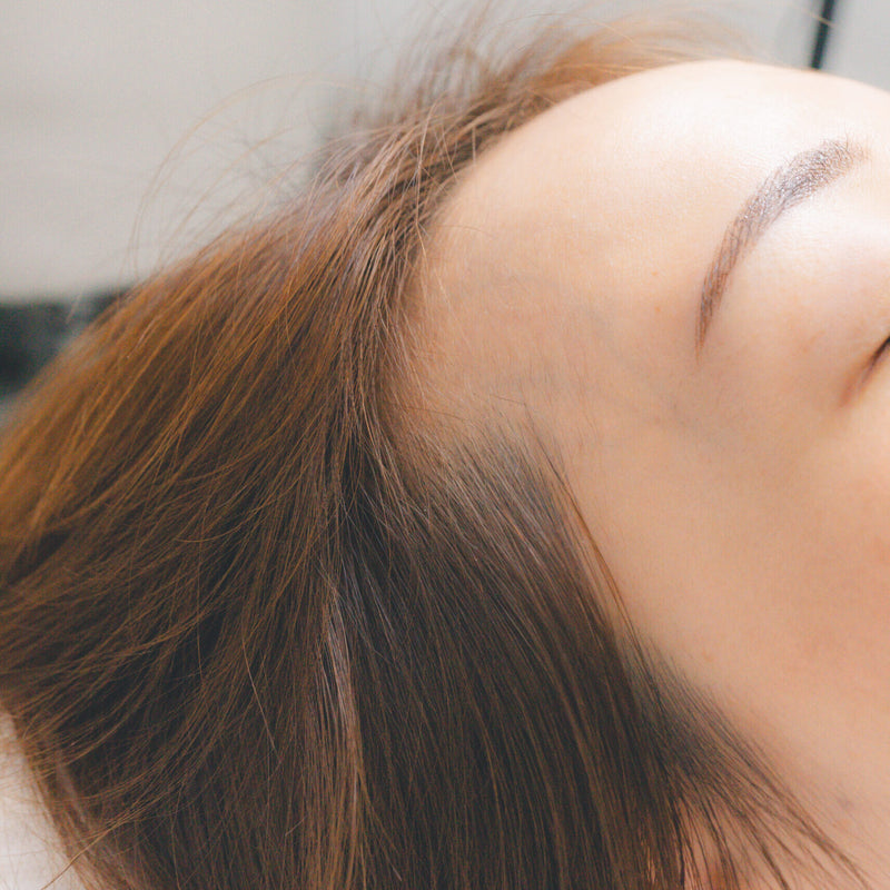ヘアラインのアートメイク施術中